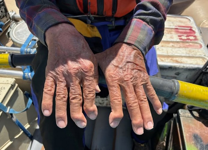 File:Erwin Oertli hands.jpg